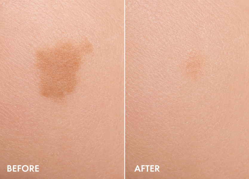 Антивіковий крем для обличчя Vichy Liftactiv В3 SPF50, 50 мл Liftactiv В3 SPF50 фото