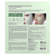 Успокаивающая коллагеновая маска Anua Heartleaf 70 + Hyaluron Soothing Collagen Mask 38 г &times; 4 шт Heartleaf 70 + Hyaluron фото 3