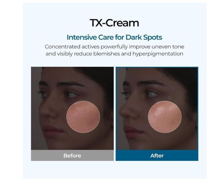 Увлажняющий крем для кожи с эффектом выравнивания тона Dr.Melaxin TX-Cream, 50 мл TX-Cream 50 фото
