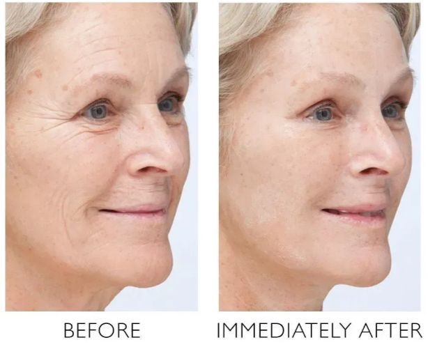 Крем для лица Peter Thomas Roth Instant FirmX Temporary Face Tightener, 100 мл Roth Instant FirmX 100 фото
